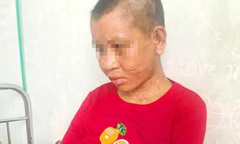 Tỉnh Gia Lai hỏa tốc yêu cầu xử lý vụ cô gái bị tra tấn dã man